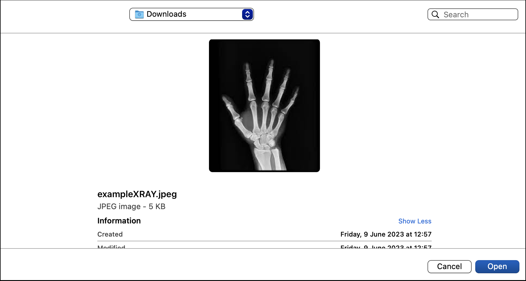 example xray.png